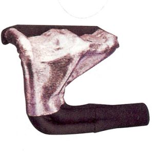 Manifold Cover